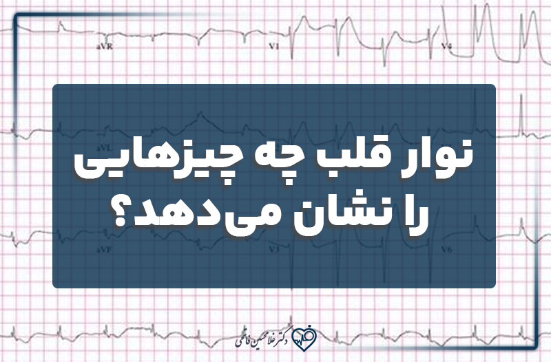 نوار قلب چه چیزهایی را نشان می‌دهد؟