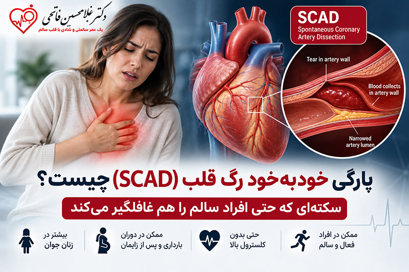 پارگی خودبه‌خود رگ قلب